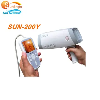 SUN-200Y Ручной медицинский портативный цифровой видео-кольпоскоп для влагалища с внешним экраном
